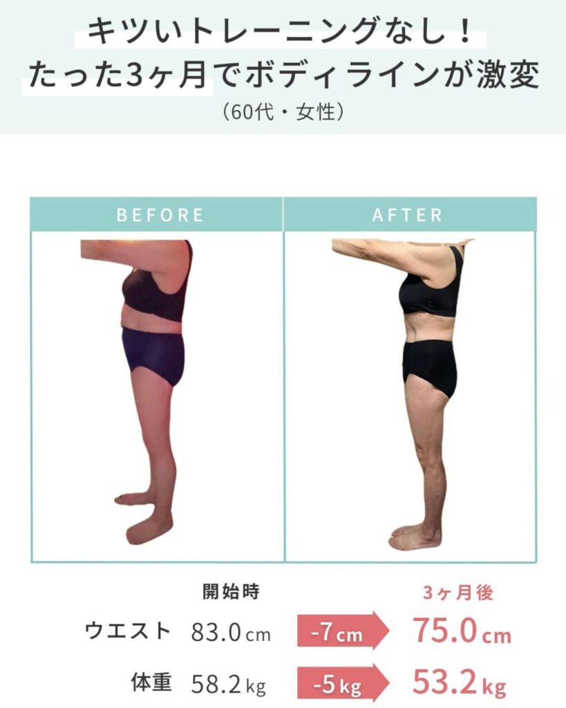 ビフォーアフター